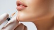 © QuietWord - Lip fillers are one of the most popular types of dermal filler close up needle and syringe injecting on woman lip