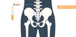 © pikovit - Lumbar puncture spinal tap