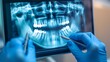© W saputro - Dentist examining panoramic x-ray in clinic