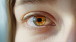 © Di - Close-up of a red, irritated eye showing visible discomfort, illustrating symptoms of eye infection, medical and health care concept.