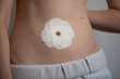 © Oleksandr Zinchenko - A person’s abdomen displays a circular adhesive patch designed for medical use. The patch adheres securely to the skin and appears clean and properly positioned, indicating a clinical application