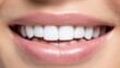 © artchvit - Oral care gum preventive health Close-up of a smiling mouth with bright, white teeth.