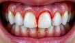 © Angelo - Dental emergency bleeding gums revealed close-up photography clinical environment health concept