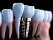 © typepng - Human dentures consist of the anatomy of healthy teeth and tooth dental implants