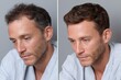 © Milos - A split image showcasing a man's hair transformation, demonstrating the impressive impact of styling on appearance and self-confidence through a side-by-side comparison.