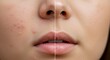 © diditlagi - Close Up Before And After Of A Woman's Face Showing Skin Improvement Results