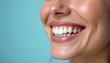 © miss irine - Beautiful healthy smile woman with white teeth closeup. Perfect teeth dental care, tooth whitening, dental clinic service advertisement. Smiling face, lip, make-up. Aesthetic dentistry, cosmetic