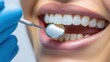 © sitifatimah - Caucasian woman undergoes dental examination, ensuring healthy teeth, gums, promoting positive well-being, cleanliness.