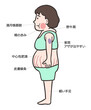 © タカボーン - クッシング症候群の女性の側面、 特徴的な体型と症状