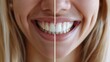 © Muhammad - Before and after teeth whitening comparison with a bright smile result