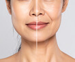 © KAMAPAN - Collage, before after and face of woman for skincare, anti aging and beauty with surgery in studio. Female model, transformation and makeover with treatment. Generated Image
