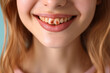 © ledor - THE young Caucasian womans close up photo reveals her inflamed gums on lovely upper jaw, highlighting lovely need for dental care and dentistry