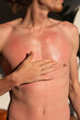 © Milles Team/Stocksy - Man applying medical solution on skin