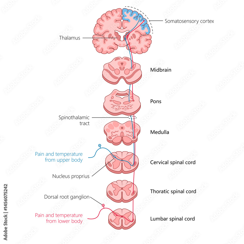 Spinothalamic Sensor tracing the spinothalamic tract, showing how pain and temperature ...
