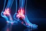 Digital illustration of human feet showing bones and joints with highlighted inflammation, representing pain or arthritis in the ankle and foot.