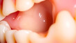 © Ann - Cavity preparation in an artificial dental tooth. Selective focus.