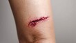 © Yevheniiya - A close-up view shows a fresh, bloody cut on human skin, highlighting the injury's details. The wound appears to be recently sustained.
