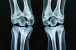 © Wizard - Xray image showing healthy human knees bone structure anatomy medical scan