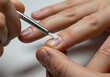 © Ramdhaniyah - Nail treatment application