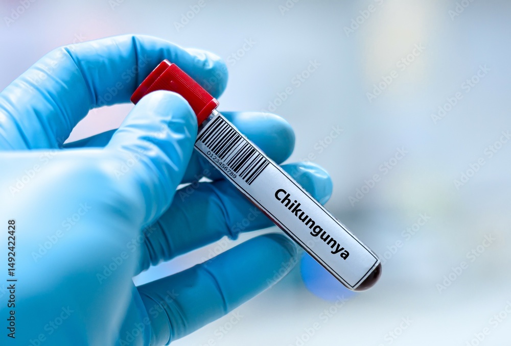 Blood sample tube for chikungunya virus test analysis. Stock Photo ...