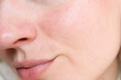 © Vikto - Close-up of natural face skin with visible pores and light redness. Ideal for skincare, pore treatment, beauty brands, and dermatology-related content.