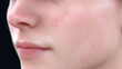 © AnyPic289 - Close up of person face showing natural skin texture
