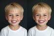 © Ольга Лукьяненко - Before and after kid teeth whitening for improved smile