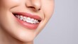 © Salander Studio - a woman with light braces smiling - close-up dental concept