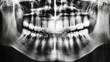 © Artsaba Family - Panoramic dental x-ray showing a full set of teeth and jawbone structure
