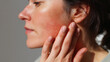 © Marut - Red irritated skin on cheek of woman pressing face with hand, showing sensitive skin condition and discomfort in closeup side profile view