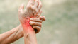 © Oporty786 - Close up of senior hand gripping inflamed wrist in pain with red highlighted area indicating joint injury or arthritis