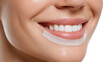 © Justlight - Closeup of smiling woman showing teeth whitening strips treatment, perfect white teeth and healthy gums, isolated on transparent background, beauty and healthcare concept