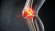 © Drago Designer - Human knee joint with pain and inflammation highlighted in red on a dark background