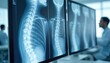 © Vadym - Close-up view of monitor displays multiple x-ray images of spinal column. Medical information for diagnosis treatment planning in clinical setting. Doctor examines x-ray images. Healthcare