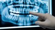 © Shahanara - Gloved hand pointing at panoramic dental xray image