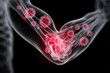 © MdTaher - 3D Medical Rendering Human Elbow Joint with Inflammation