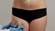 © kinomaster - Preparation for Aesthetic Body Contouring Procedure Consultation