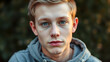 © Alexandra - Caucasian Teenage Boy with Acne A Caucasian teenage boy with acn