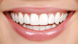 © Pimnon - Close-up of a bright, healthy smile showcasing clean, white teeth and well-moisturized lips.