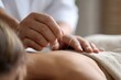 © Oleksandr - Healing Acupuncture. Female Patient Receiving Oriental Acupuncture Treatment in Spa
