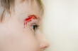 © kajasja - Close-up of the boy's face with a sadina. The child treats the wound on the face. High quality photo