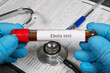 © Богдан Стеблянко - Doctor holding blood sample for ebola test