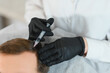 © Serhii - Side view of handsome man getting hair treatment at beauty salon. Man having mesotherapy session at aesthetic clinic, therapist hands in gloves making injection in scalp