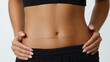 © Nova Zigres - Woman's belly with a well-healed scar below the navel on white background