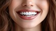 © andi - Close-up of a woman's happy smile with perfect teeth