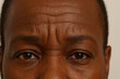 © Alessandro Grandini - Forehead of a worried senior black man showing wrinkles and concern