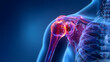 © Daniel - Shoulder joint replacement implant - X-ray view - Medically 3D illustration with blue background
