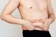 © Ольга Шефер - An adult Caucasian man showing fat folds on his stomach with his hands. Obesity, overweight.