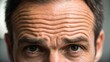 © JT-Dee - Close-up of a mature man's forehead showing deep wrinkles and expressive brown eyes with a concerned or thoughtful expression.