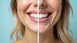 © Konstantin - Photo of woman split in half before and after teeth whitening close up. Dental care concept, collage design